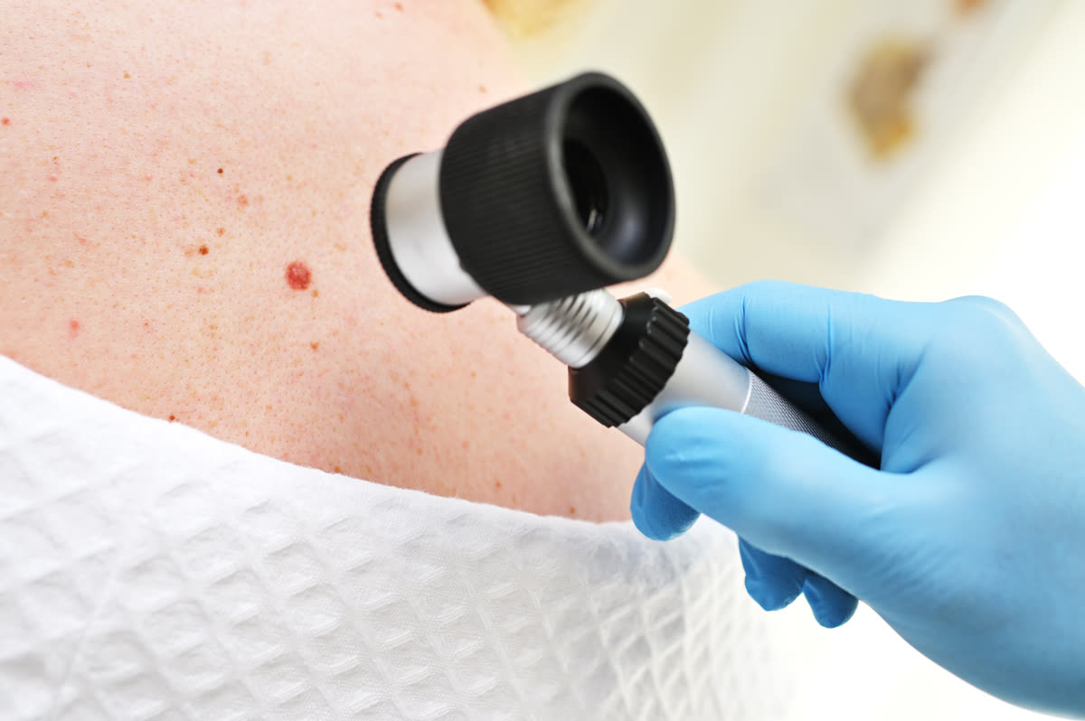 Dermatologista examinando a pele com dermatoscópio